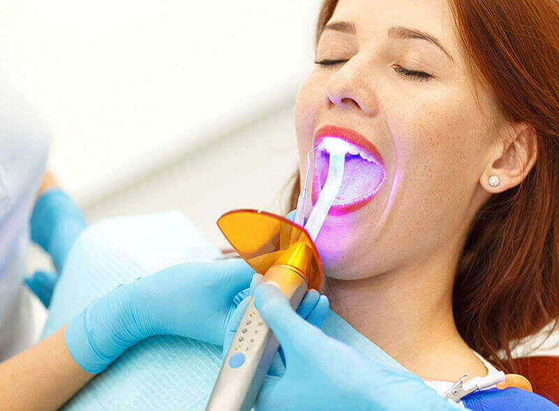 Dental Bonding Wetaskiwin