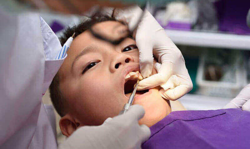 Tooth Extractions Wetaskiwin